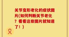 关节变形老化的症状图片(如何判断关节老化？看看这些图片就知道了！)