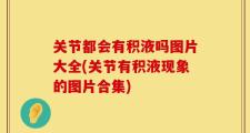 关节都会有积液吗图片大全(关节有积液现象的图片合集)