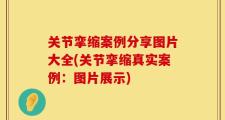关节挛缩案例分享图片大全(关节挛缩真实案例：图片展示)