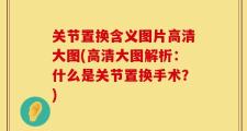 关节置换含义图片高清大图(高清大图解析：什么是关节置换手术？)