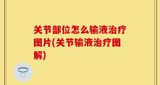 关节部位怎么输液治疗图片(关节输液治疗图解)