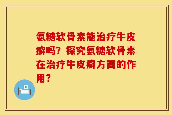氨糖软骨素能治疗牛皮癣吗？探究氨糖软骨素在治疗牛皮癣方面的作用？