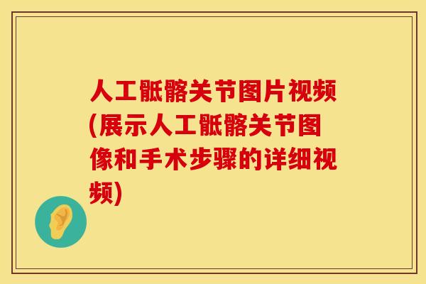 人工骶髂关节图片视频(展示人工骶髂关节图像和手术步骤的详细视频)