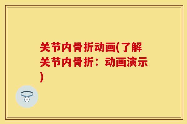 关节内骨折动画(了解关节内骨折：动画演示)