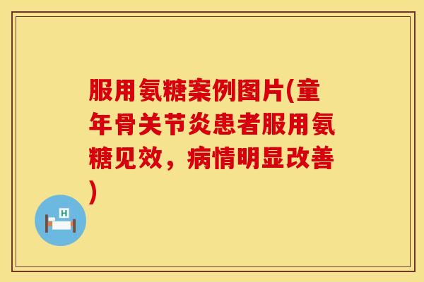 服用氨糖案例图片(童年骨患者服用氨糖见效,情明显改善) 服用氨糖案例图片(童年骨患者服用氨糖见效,情明显改善)