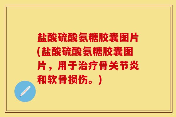 盐酸硫酸氨糖胶囊图片(盐酸硫酸氨糖胶囊图片,用于骨和软骨损伤。) 盐酸硫酸氨糖胶囊图片(盐酸硫酸氨糖胶囊图片,用于骨和软骨损伤。)