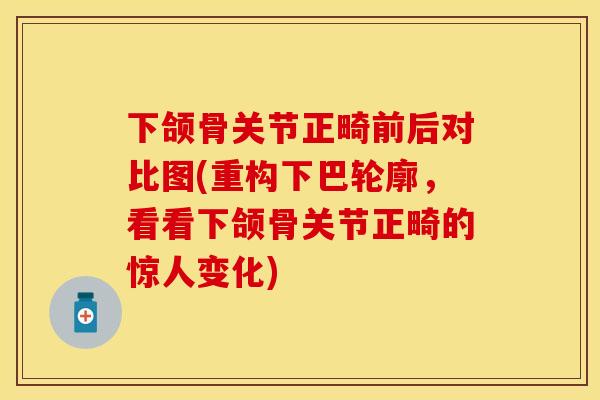 下颌骨关节正畸前后对比图(重构下巴轮廓,看看下颌骨关节正畸的惊人变化) 下颌骨关节正畸前后对比图(重构下巴轮廓,看看下颌骨关节正畸的惊人变化)