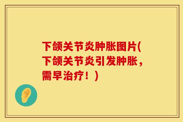 下颌关节炎肿胀图片(下颌关节炎引发肿胀，需早治疗！)