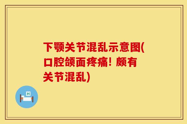 下颚关节混乱示意图(口腔颌面! 颇有关节混乱) 下颚关节混乱示意图(口腔颌面! 颇有关节混乱)