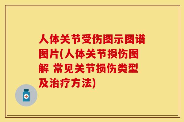 人体关节受伤图示图谱图片(人体关节损伤图解 常见关节损伤类型及治疗方法)