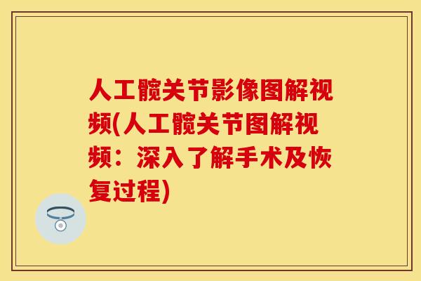 人工髋关节影像图解视频(人工髋关节图解视频：深入了解手术及恢复过程)