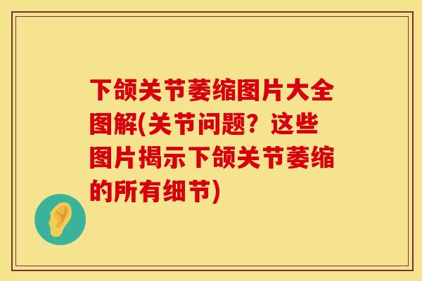 下颌关节萎缩图片大全图解(关节问题？这些图片揭示下颌关节萎缩的所有细节)