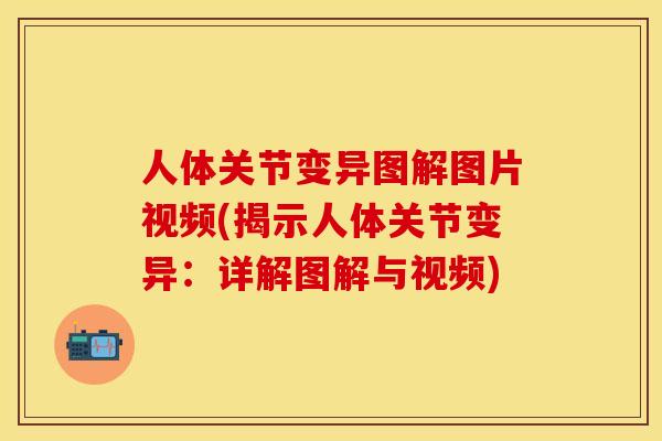 人体关节变异图解图片视频(揭示人体关节变异：详解图解与视频)