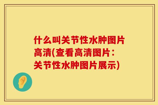 什么叫关节性水肿图片高清(查看高清图片：关节性水肿图片展示)