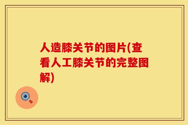 人造膝关节的图片(查看人工膝关节的完整图解)