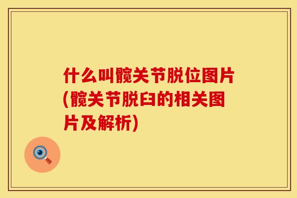 什么叫髋关节脱位图片(髋关节脱臼的相关图片及解析)