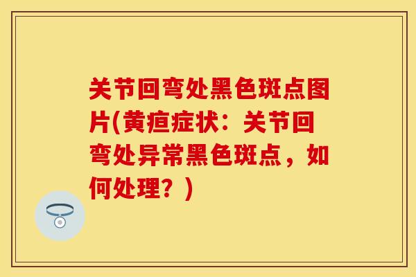 关节回弯处黑色斑点图片(黄疸症状：关节回弯处异常黑色斑点，如何处理？)