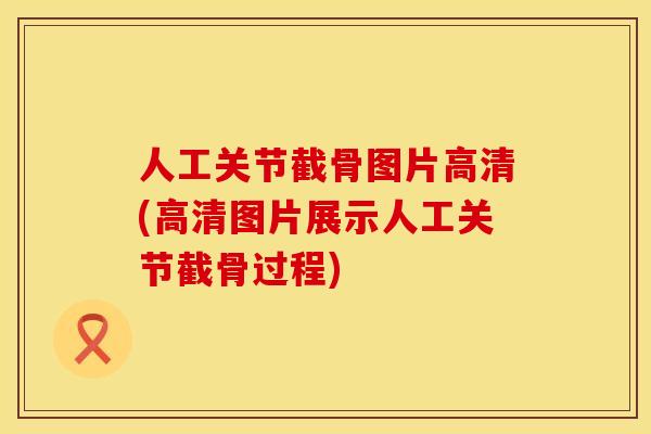 人工关节截骨图片高清(高清图片展示人工关节截骨过程)