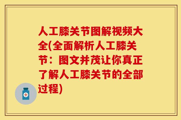 人工膝关节图解视频大全(全面解析人工膝关节:图文并茂让你真正了解人工膝关节的全部过程) 人工膝关节图解视频大全(全面解析人工膝关节:图文并茂让你真正了解人工膝关节的全部过程)