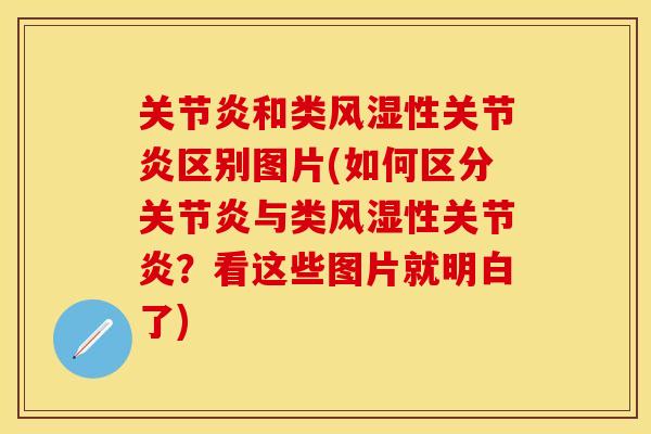 关节炎和类风湿性关节炎区别图片(如何区分关节炎与类风湿性关节炎？看这些图片就明白了)