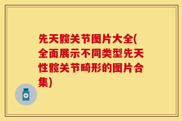先天髋关节图片大全(全面展示不同类型先天性髋关节畸形的图片合集)