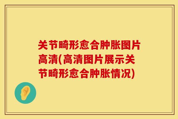 关节畸形愈合肿胀图片高清(高清图片展示关节畸形愈合肿胀情况)