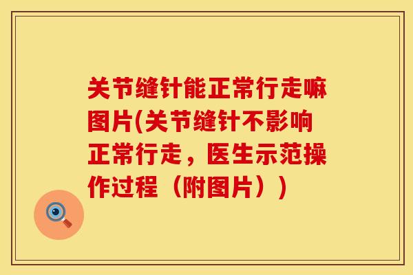 关节缝针能正常行走嘛图片(关节缝针不影响正常行走，医生示范操作过程（附图片）)