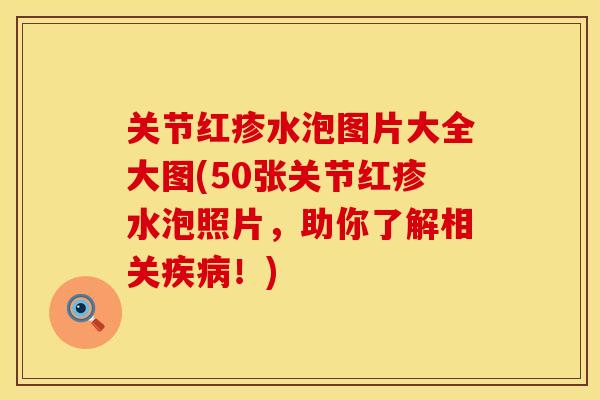 关节红疹水泡图片大全大图(50张关节红疹水泡照片,助你了解相关疾病!)