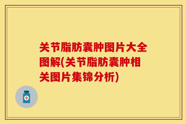 关节脂肪囊肿图片大全图解(关节脂肪囊肿相关图片集锦分析)