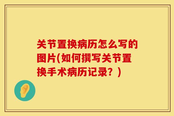 关节置换病历怎么写的图片(如何撰写关节置换手术病历记录？)