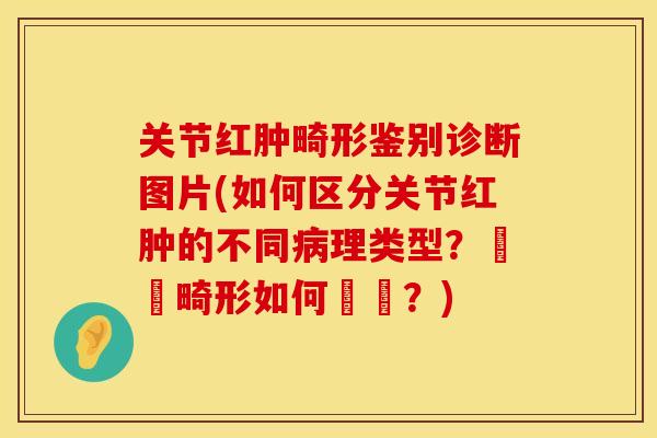 关节红肿畸形鉴别诊断图片(如何区分关节红肿的不同病理类型？關節畸形如何鑑別？)