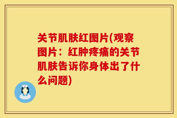 关节肌肤红图片(观察图片：红肿疼痛的关节肌肤告诉你身体出了什么问题)