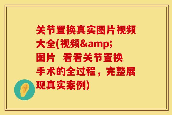 关节置换真实图片视频大全(视频&图片  看看关节置换手术的全过程，完整展现真实案例)