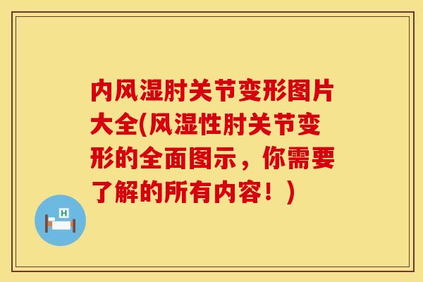 内风湿肘关节变形图片大全(风湿性肘关节变形的全面图示,你需要了解的所有内容!)