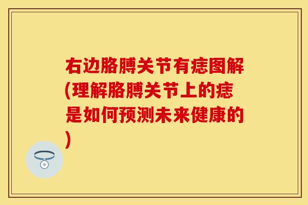 右边胳膊关节有痣图解(理解胳膊关节上的痣是如何预测未来健康的) 右边胳膊关节有痣图解(理解胳膊关节上的痣是如何预测未来健康的)