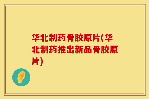 华北制药骨胶原片(华北制药推出新品骨胶原片)
