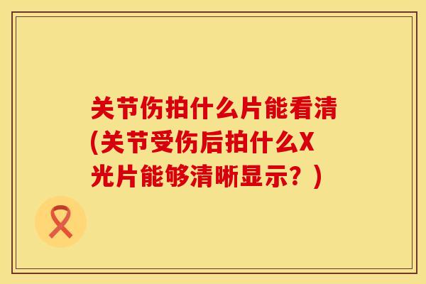 关节伤拍什么片能看清(关节受伤后拍什么X光片能够清晰显示？)