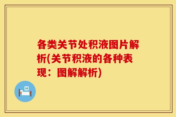 各类关节处积液图片解析(关节积液的各种表现：图解解析)
