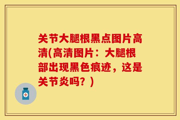 关节大腿根黑点图片高清(高清图片：大腿根部出现黑色痕迹，这是关节炎吗？)