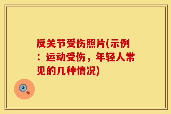 反关节受伤照片(示例：运动受伤，年轻人常见的几种情况)