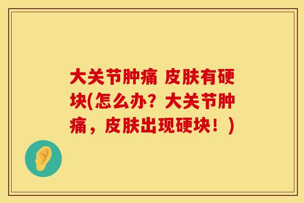 大关节肿痛 皮肤有硬块(怎么办？大关节肿痛，皮肤出现硬块！)