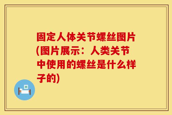 固定人体关节螺丝图片(图片展示：人类关节中使用的螺丝是什么样子的)