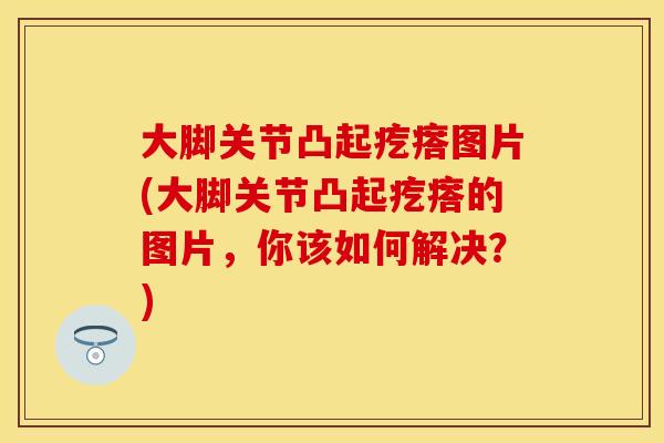 大脚关节凸起疙瘩图片(大脚关节凸起疙瘩的图片，你该如何解决？)