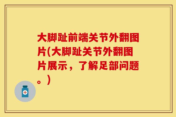 大脚趾前端关节外翻图片(大脚趾关节外翻图片展示，了解足部问题。)