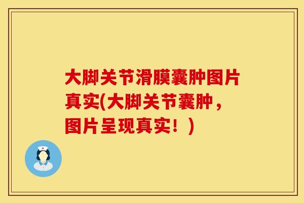 大脚关节滑膜囊肿图片真实(大脚关节囊肿，图片呈现真实！)