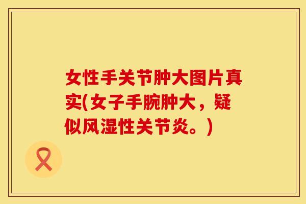 女性手关节肿大图片真实(女子手腕肿大，疑似风湿性关节炎。)