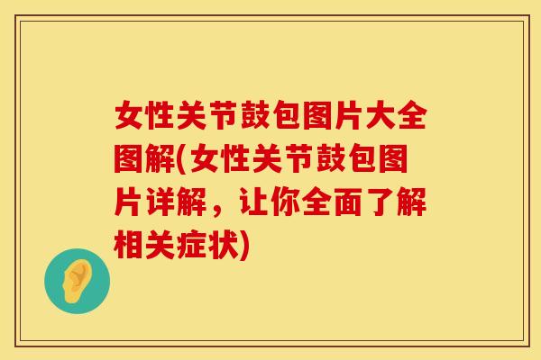 女性关节鼓包图片大全图解(女性关节鼓包图片详解，让你全面了解相关症状)