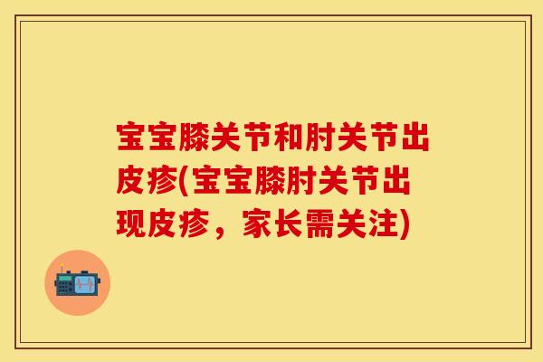 宝宝膝关节和肘关节出皮疹(宝宝膝肘关节出现皮疹,家长需关注) 宝宝膝关节和肘关节出皮疹(宝宝膝肘关节出现皮疹,家长需关注)