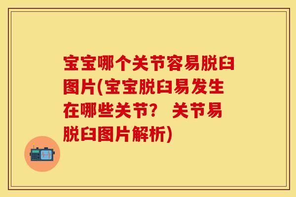 宝宝哪个关节容易脱臼图片(宝宝脱臼易发生在哪些关节？ 关节易脱臼图片解析)