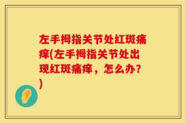 左手拇指关节处红斑痛痒(左手拇指关节处出现红斑痛痒，怎么办？)